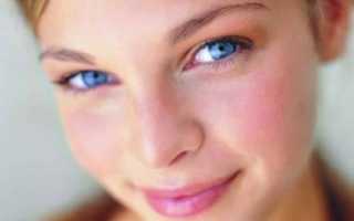 Причины и лечение красных щек у взрослых