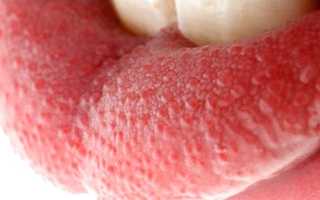 Пупырышки на языке