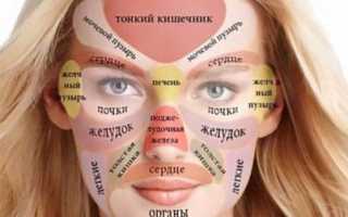 Что такое акне и как быстро от него избавиться