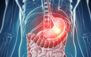 Признаки кератодермии на ладонях рук и подошве ног