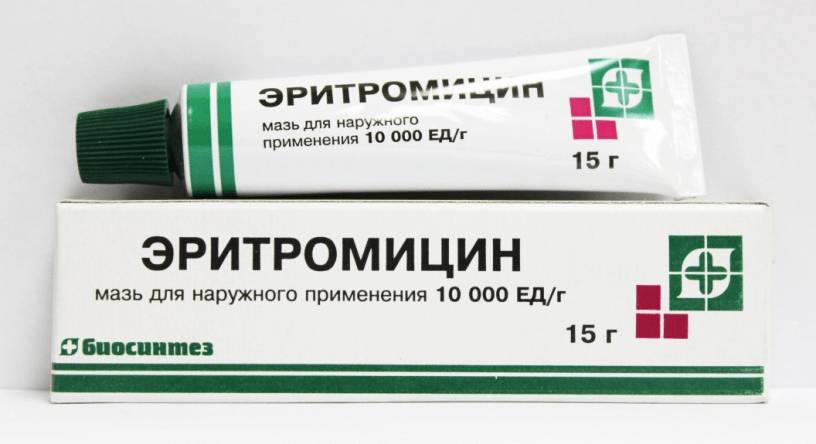 Лечение трофической язвы при варикозе ног