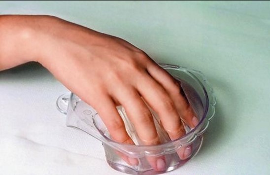 Что такое панариций и как его вылечить