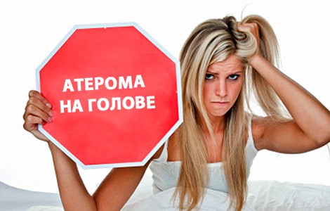 Признаки и лечение атеромы