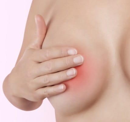 Отчего может чесаться молочные железы у женщин