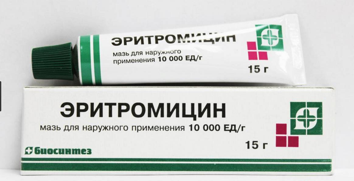Признаки скарлатины у взрослых и методы лечения