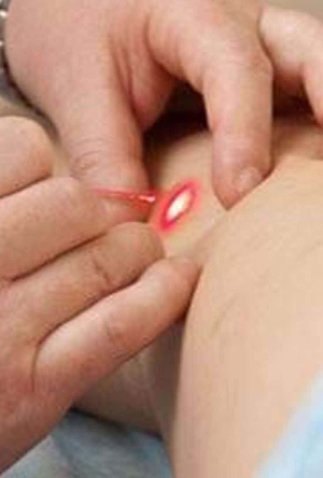 Лечение контагиозного моллюска на коже