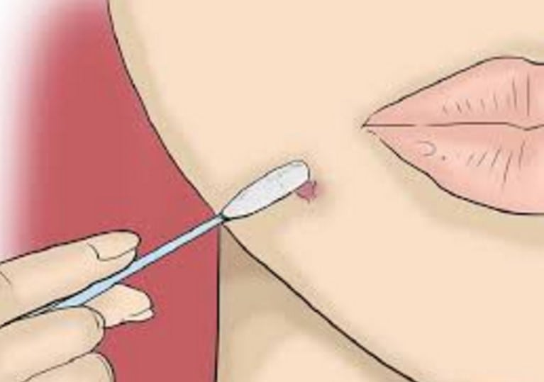 Лечение и причины папул на коже