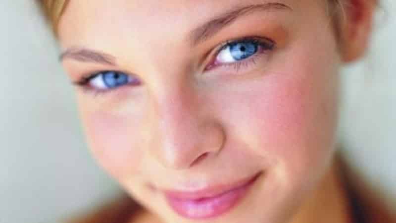 Причины и лечение красных щек у взрослых