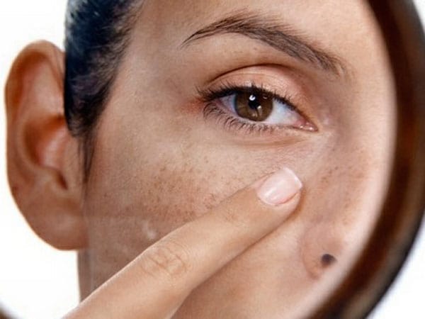 Как выглядят высыпания на коже при болезнях печени