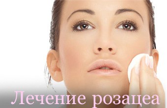 Лечение розацеа на лице