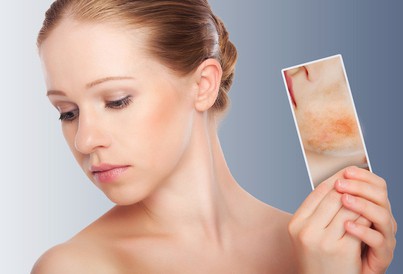 Синдром Лайелла у детей и взрослых