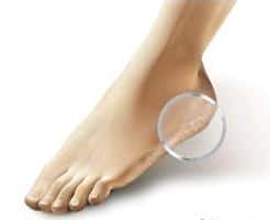 Причины сухой кожи на ногах