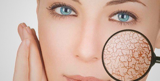 Основные причины очень сухой кожи