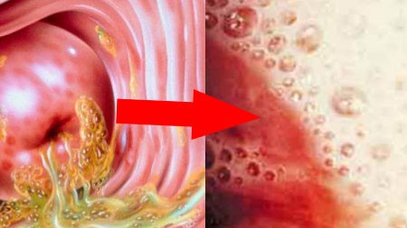 первые признаки трихомониаза у женщин первые признаки трихомониаза у женщин