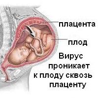 Цитомегаловирус у беременных