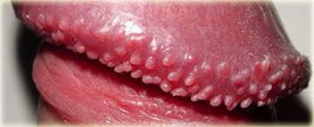 Перламутровые папулы на члене