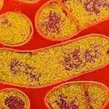 Ботулизм - острое отравление пищей, содержащей опасный нейротоксин, который вырабатывают бактерии Клостридум ботулинум Ботулизм - острое отравление пищей, содержащей опасный нейротоксин, который вырабатывают бактерии Клостридум ботулинум