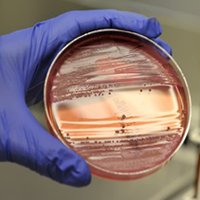 Анализ на бруцеллез Анализ на бруцеллез