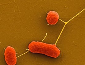Бактерии под микроскопом Бактерии под микроскопом