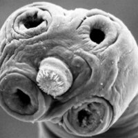 Гименолепидоз Гименолепидоз