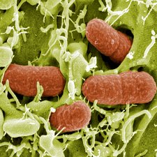 Инфекция Инфекция