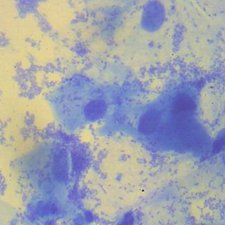 Кокковая флора на мазке Кокковая флора на мазке