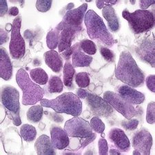 Микоплазма Микоплазма