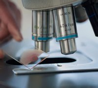 Анализ под микроскопом Анализ под микроскопом