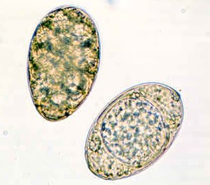 Яйца Diphillobothrium latum Яйца Diphillobothrium latum