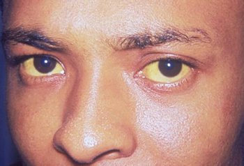 Желтые глаза Желтые глаза