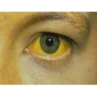 Желтый глаз Желтый глаз